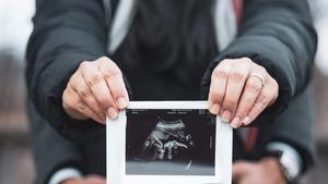 Couple showing their baby's ultrasound photo.