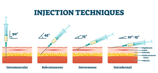 Diagram of different injection techniques.