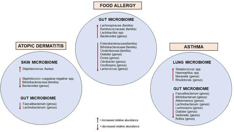 Diagram of bacterial abundance relation to allergies.